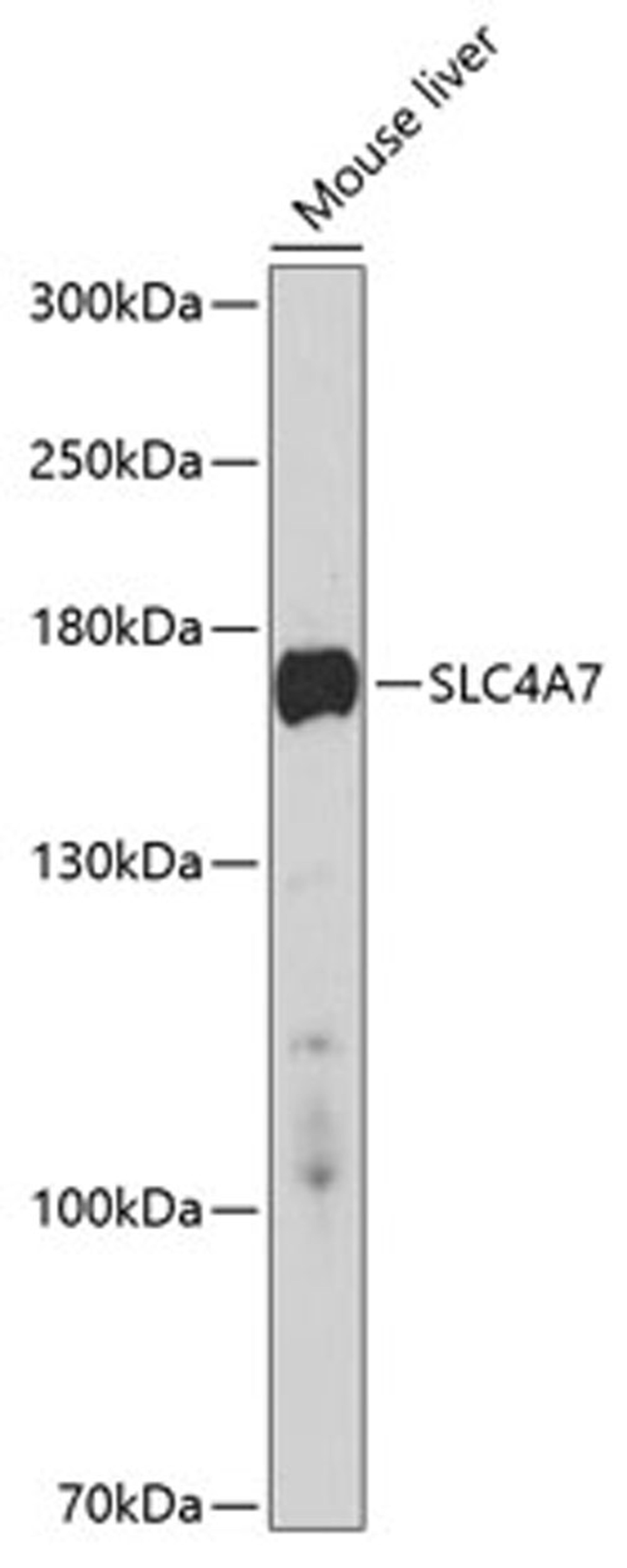 Western blot - SLC4A7 antibody (A10271)