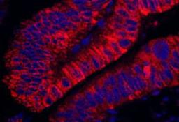 Detection of human ARHGEF5 by immunohistochemistry.