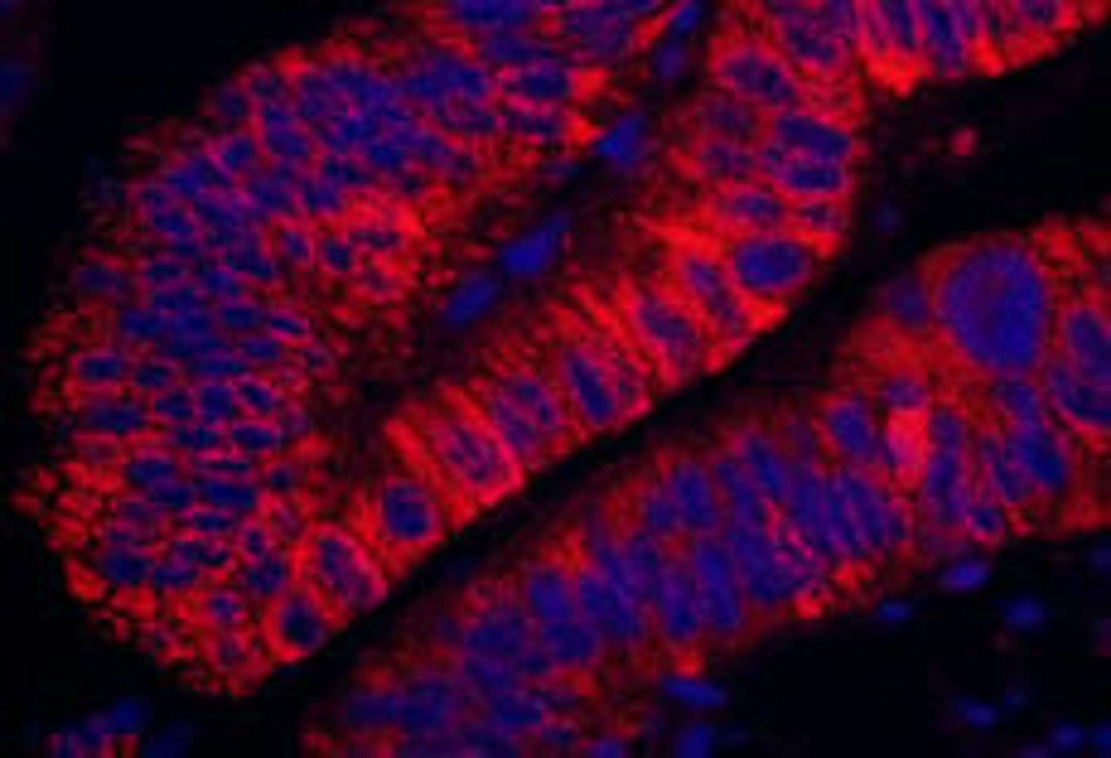 Detection of human ARHGEF5 by immunohistochemistry.