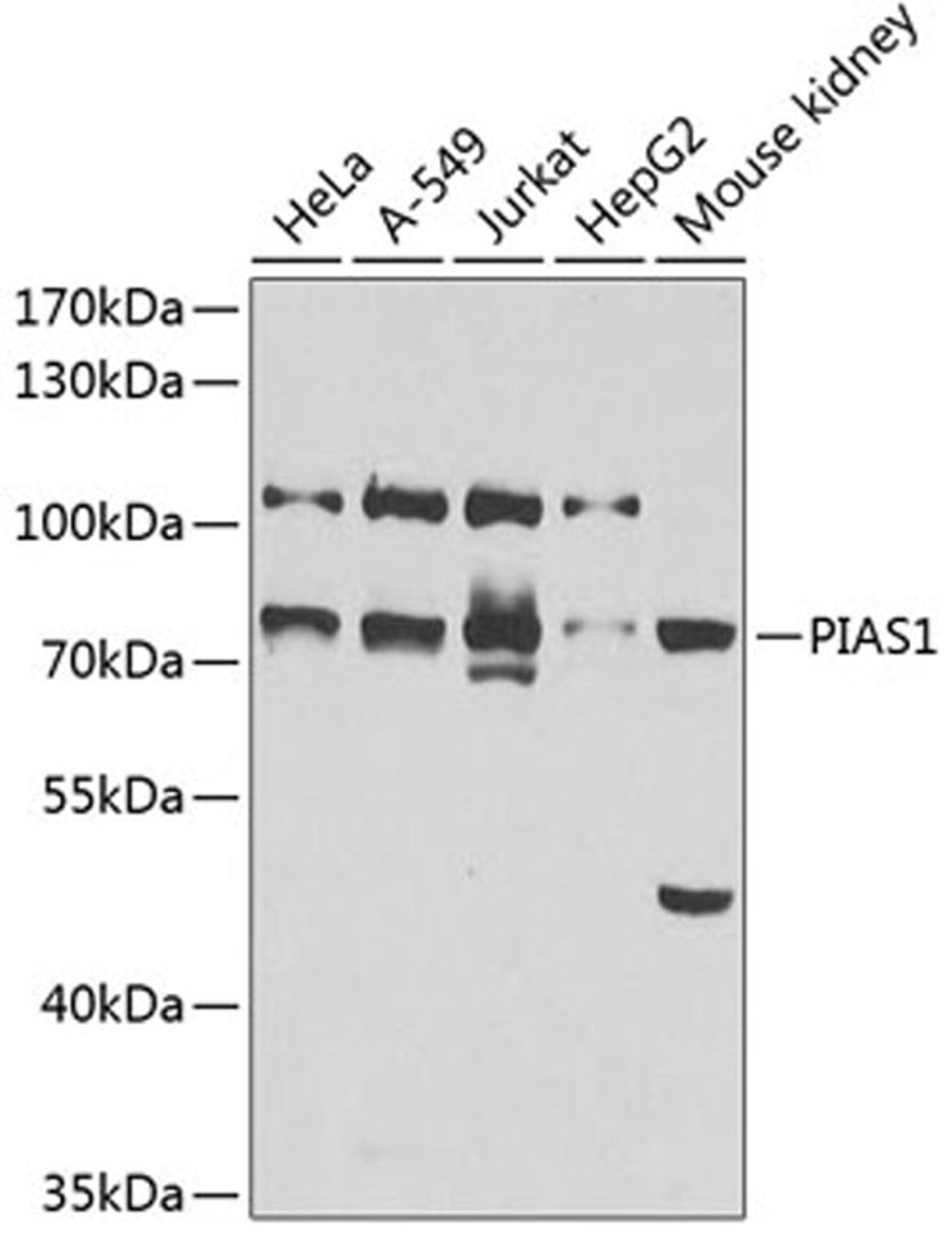 Western blot - PIAS1 antibody (A1007)