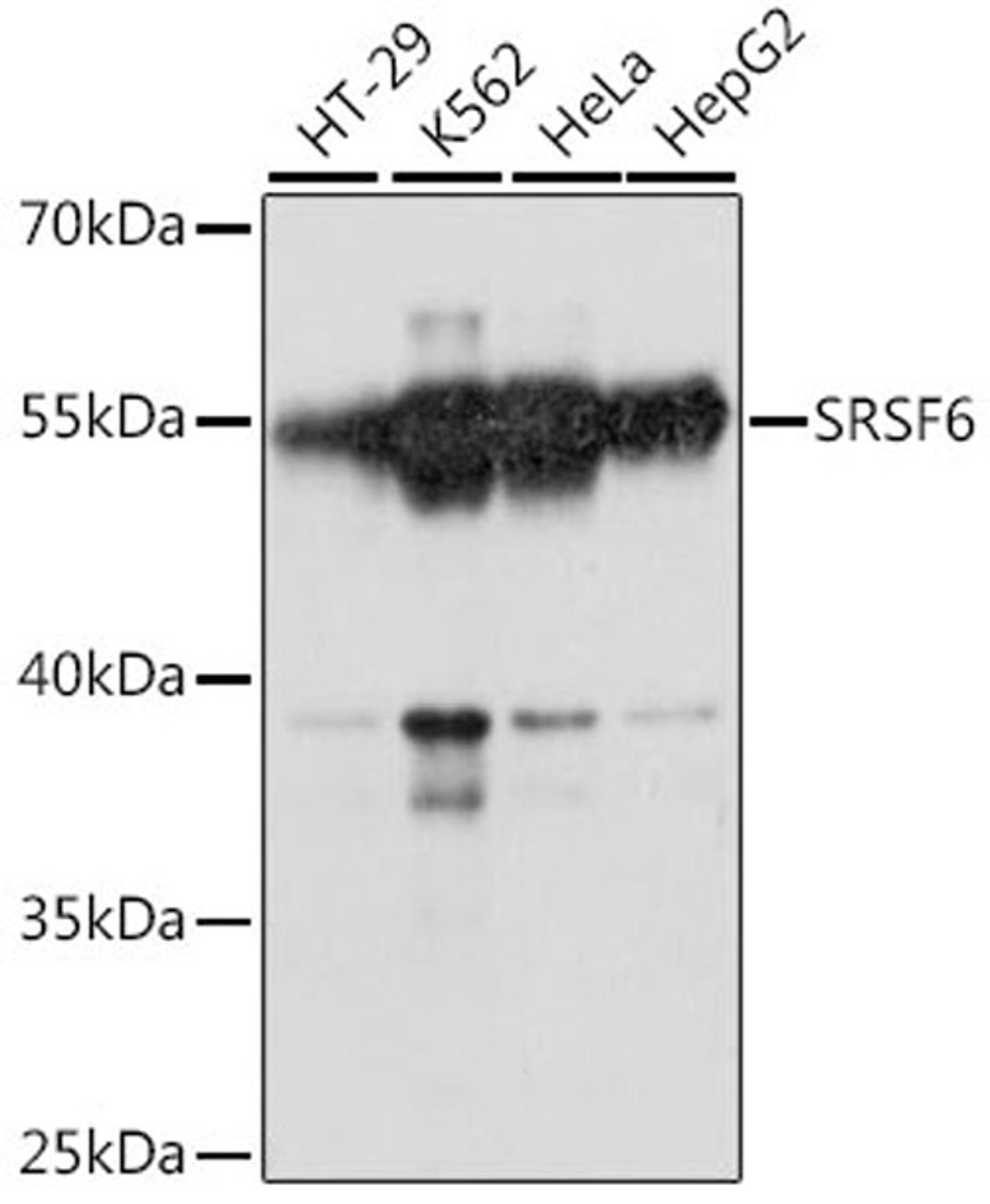 Western blot - SRSF6 antibody (A14603)