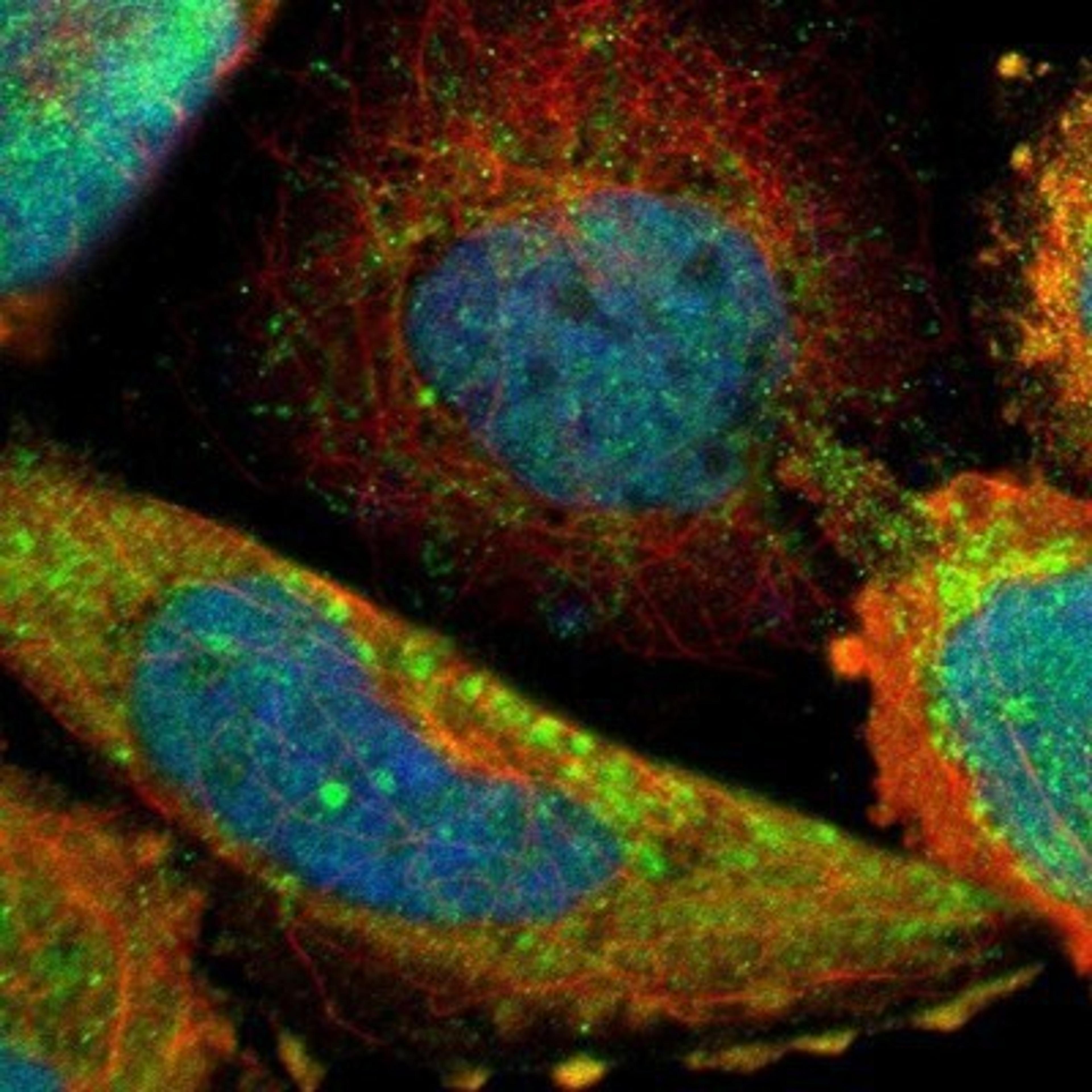 Immunocytochemistry/Immunofluorescence: DLST Antibody [NBP1-85012] - Staining of human cell line A-431 shows positivity in nucleus but not nucleoli, cytoplasm & mitochondria.