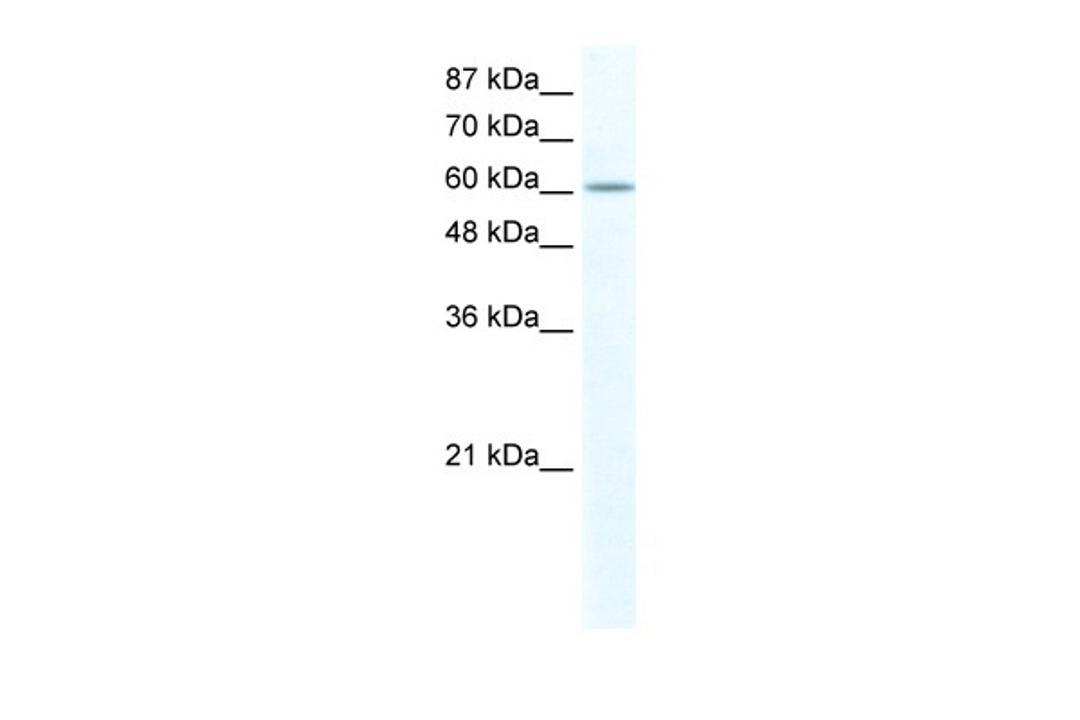 Antibody used in WB on Human HepG2 cells at 2.5 ug/ml.