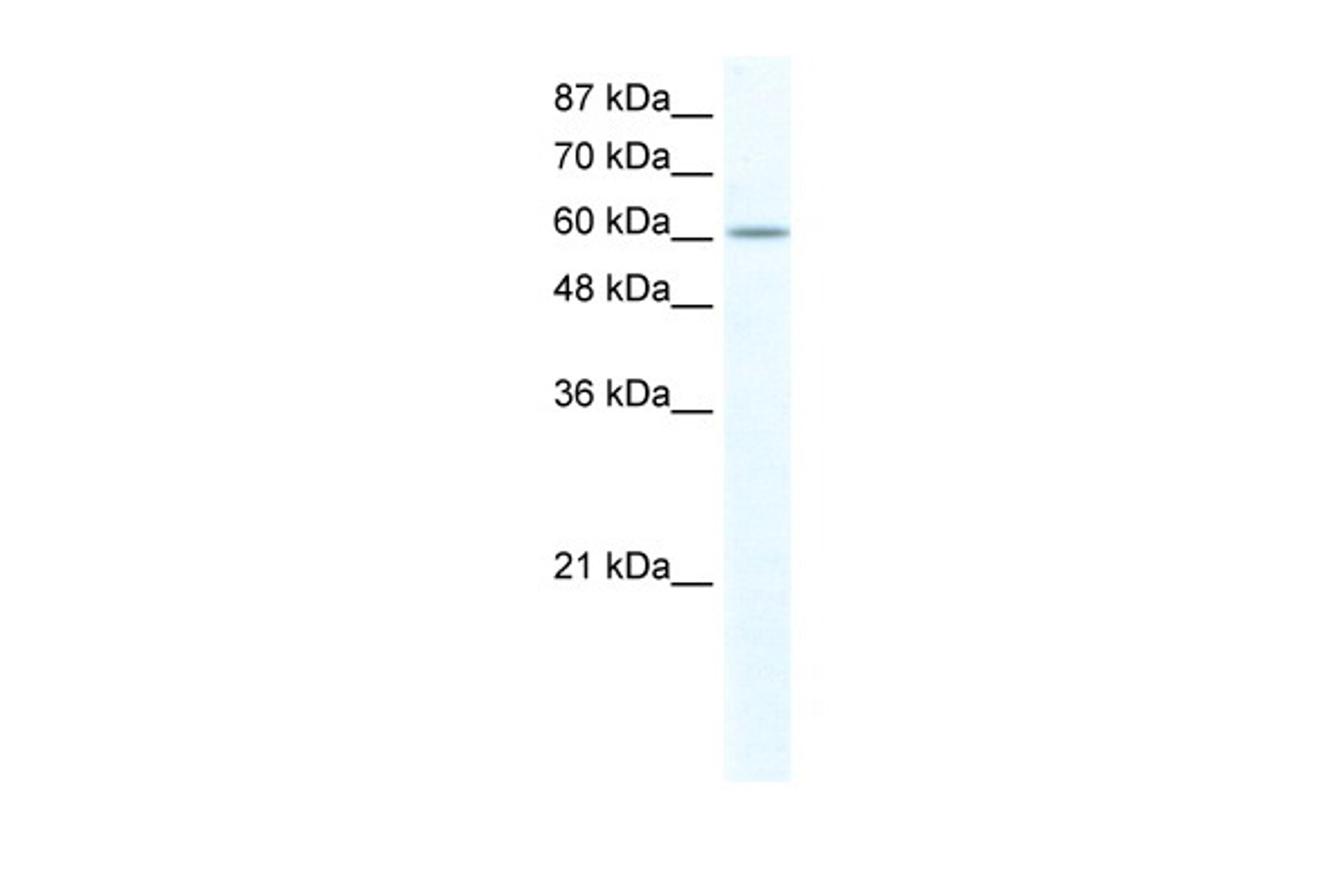 Antibody used in WB on Human HepG2 cells at 2.5 ug/ml.