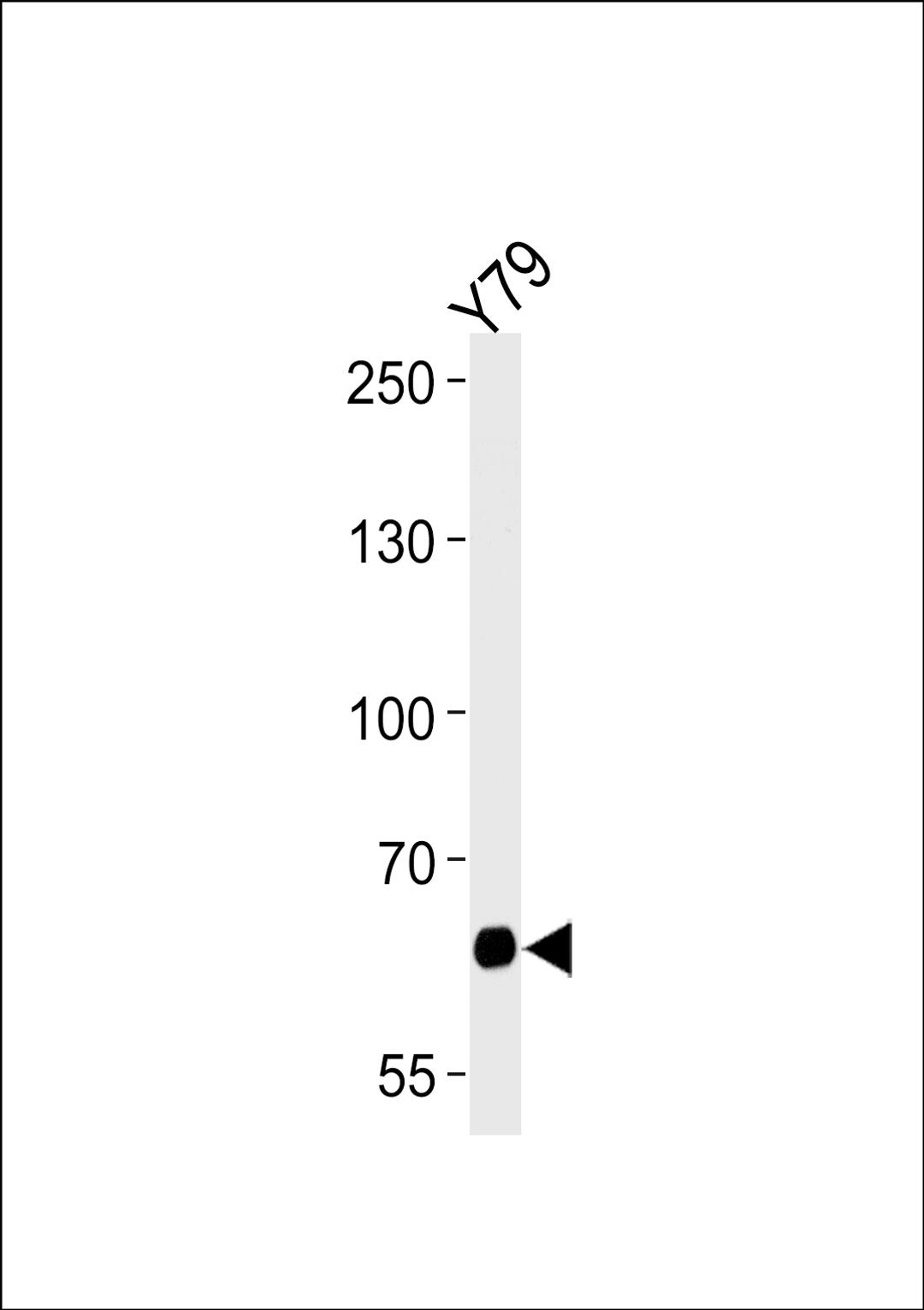 Western blot analysis of lysate from Y79 cell line, using PPEF2 Antibody at 1:1000 at each lane.