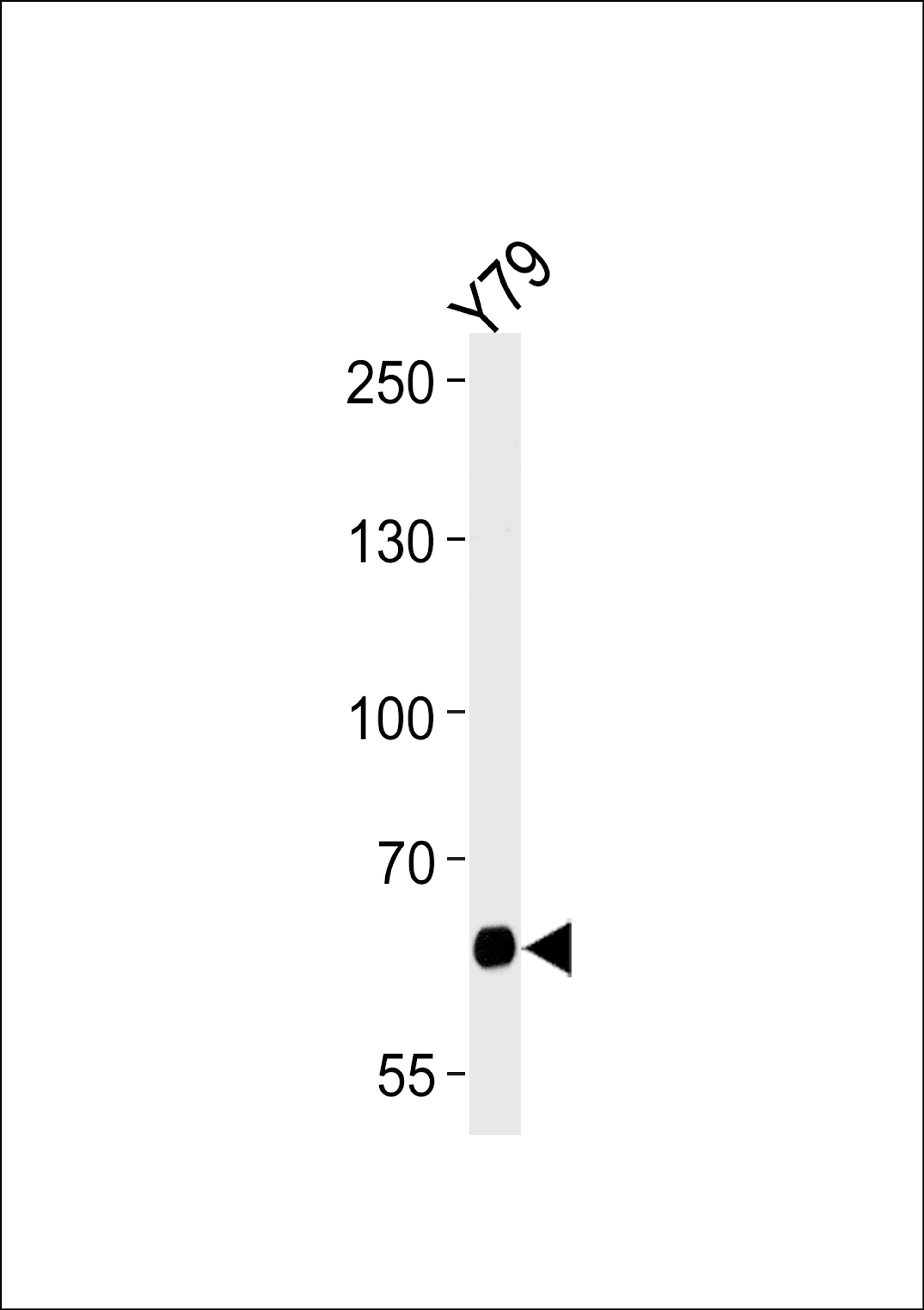 Western blot analysis of lysate from Y79 cell line, using PPEF2 Antibody at 1:1000 at each lane.