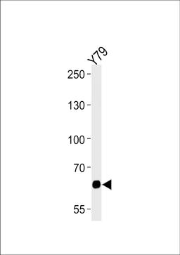 Western blot analysis of lysate from Y79 cell line, using PPEF2 Antibody at 1:1000 at each lane.