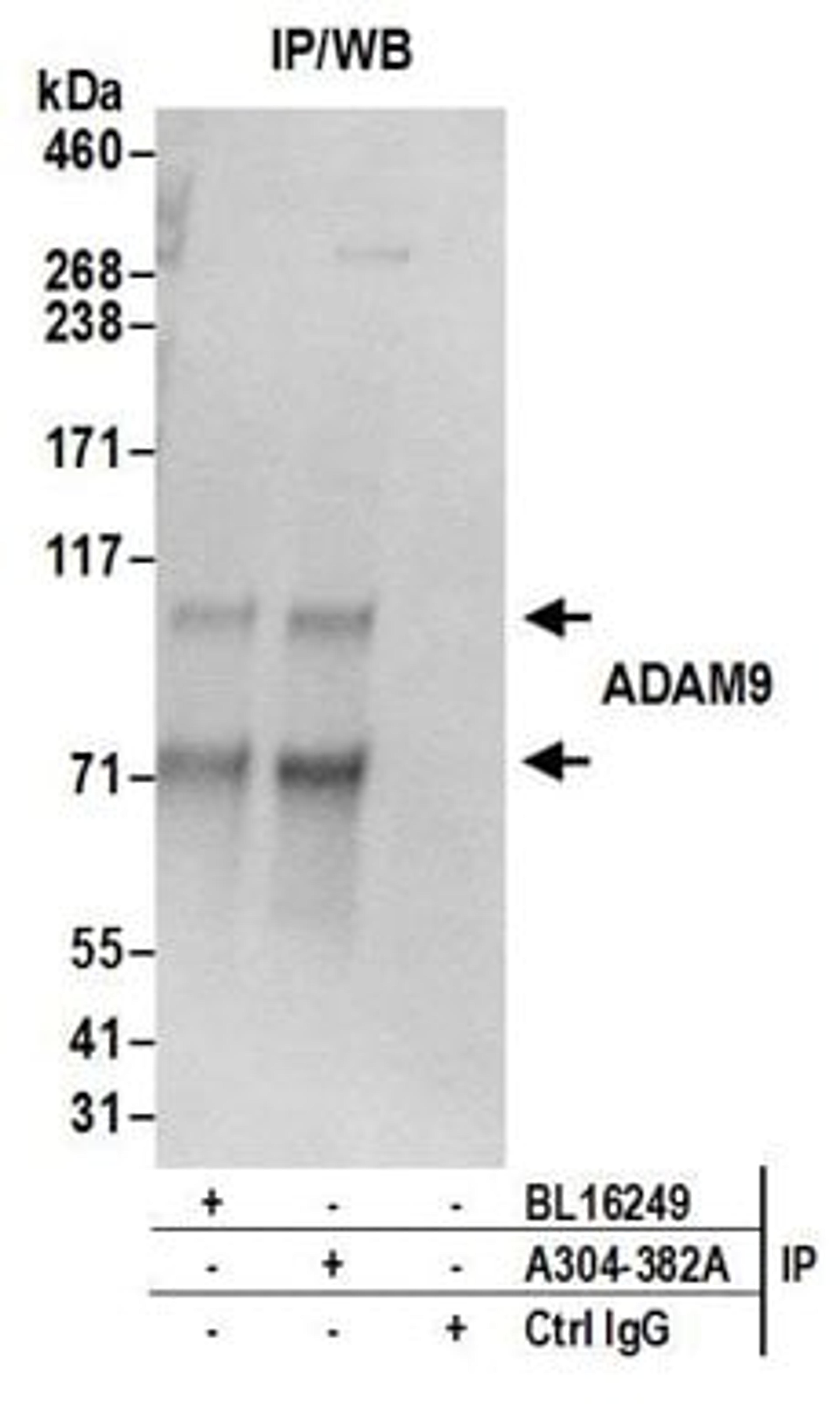 Detection of human ADAM9 by western blot of immunoprecipitates.