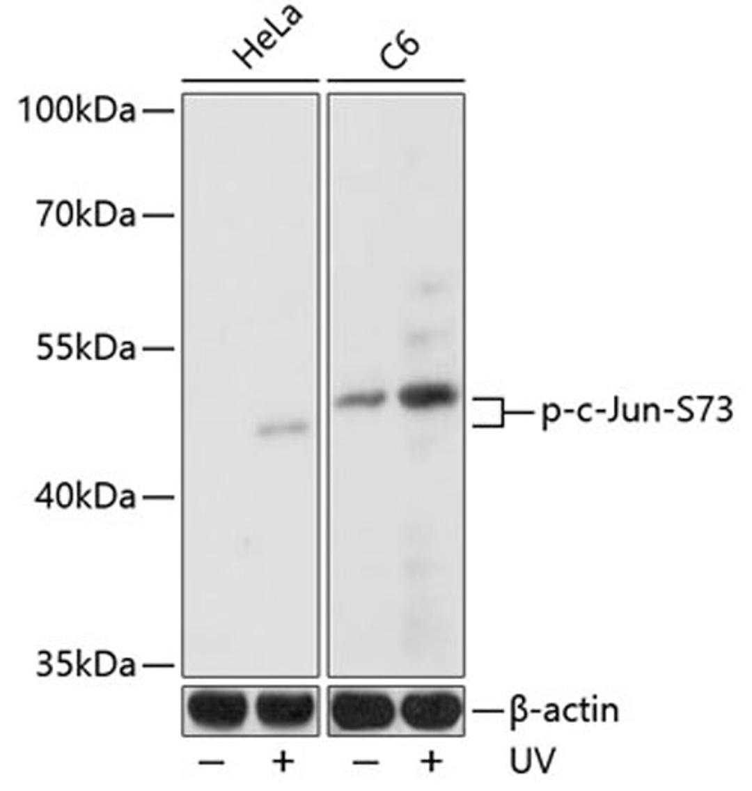 Western blot - Phospho-c-Jun-S73 antibody (AP0047)