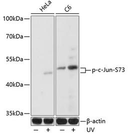 Western blot - Phospho-c-Jun-S73 antibody (AP0047)