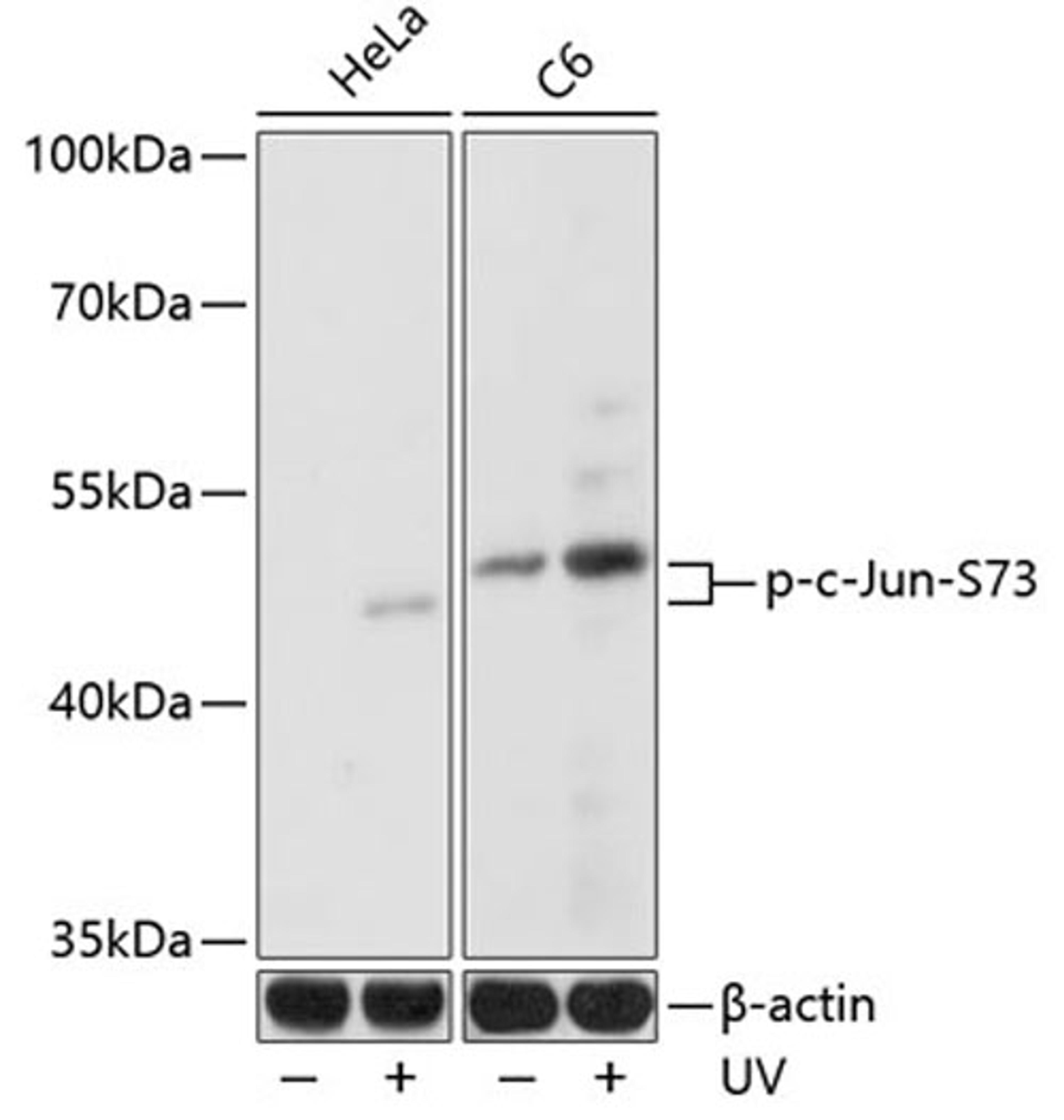 Western blot - Phospho-c-Jun-S73 antibody (AP0047)