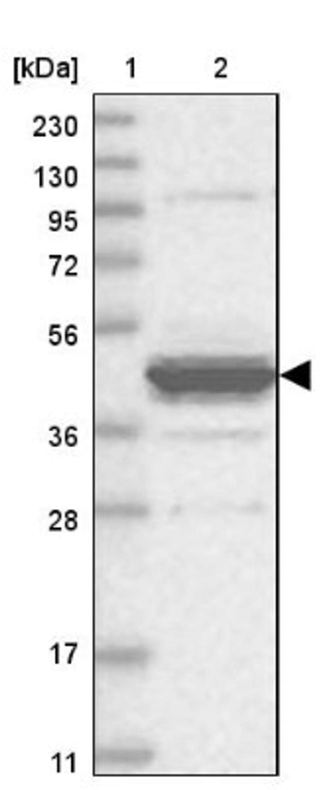 Western Blot: EPHX4 Antibody [NBP1-89307] - Lane 1: Marker [kDa] 230, 130, 95, 72, 56, 36, 28, 17, 11<br/>Lane 2: Human cell line RT-4