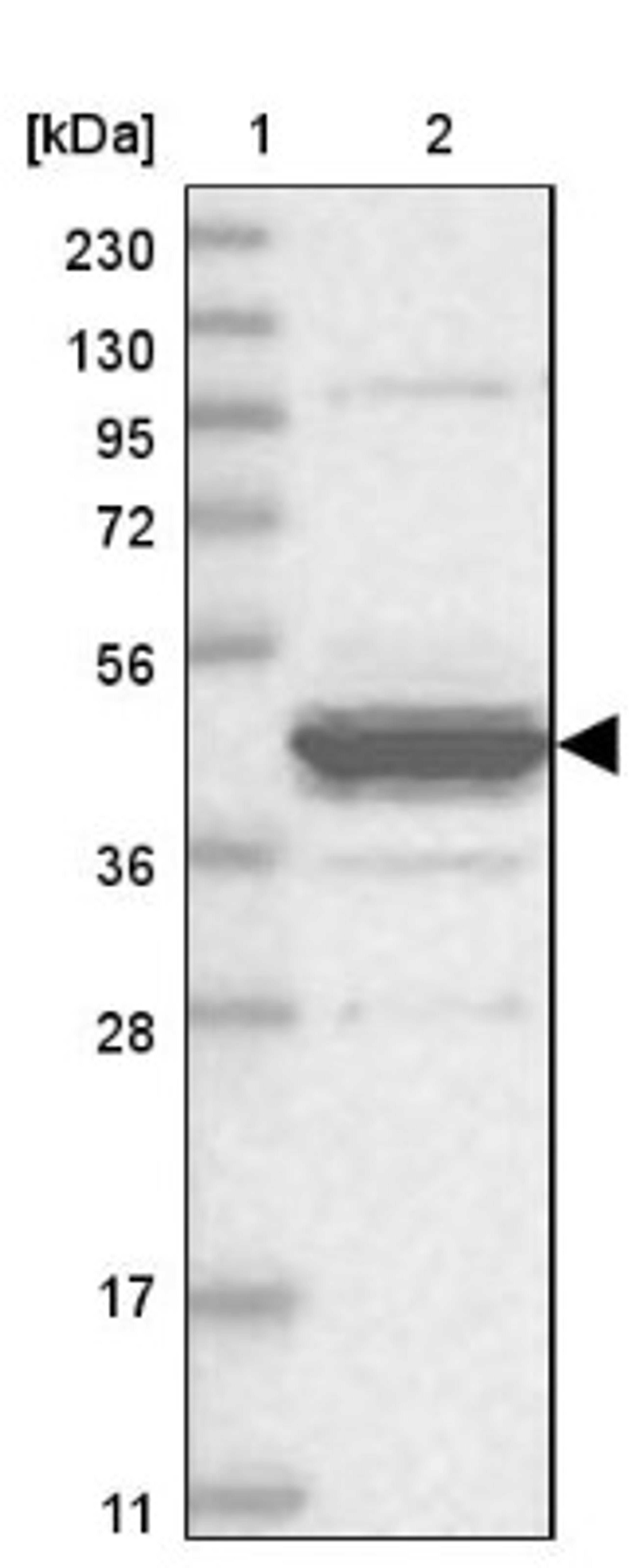 Western Blot: EPHX4 Antibody [NBP1-89307] - Lane 1: Marker [kDa] 230, 130, 95, 72, 56, 36, 28, 17, 11<br/>Lane 2: Human cell line RT-4