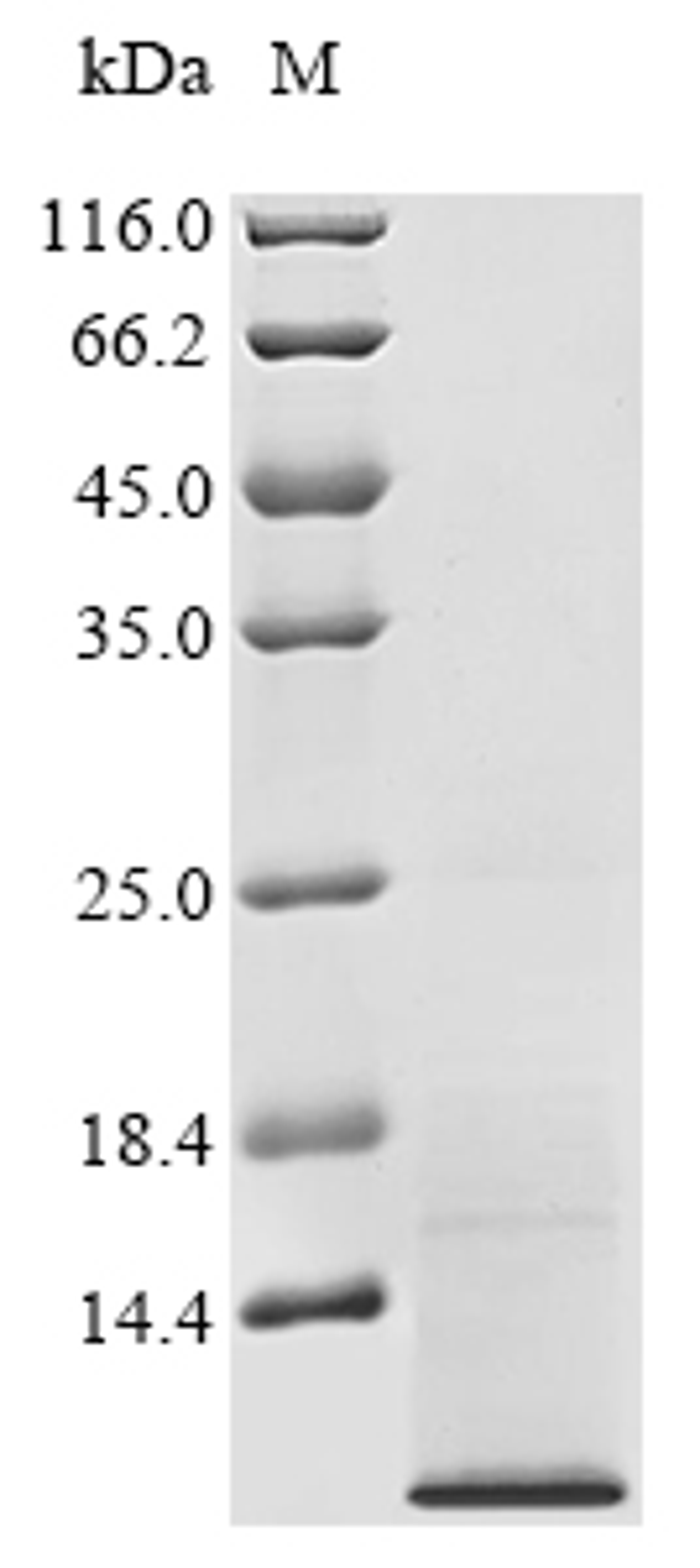 (Tris-Glycine gel) Discontinuous SDS-PAGE (reduced) with 5% enrichment gel and 15% separation gel.