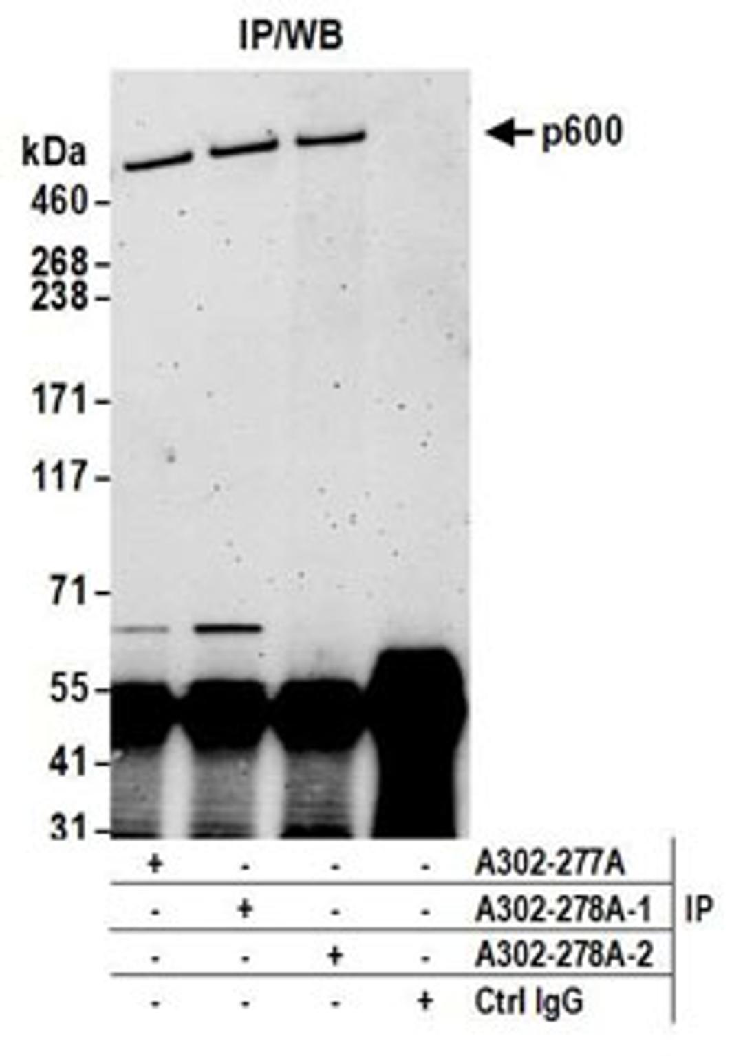 Detection of human p600 by western blot of immunoprecipitates.