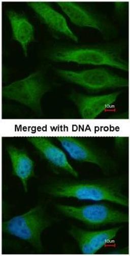 Immunocytochemistry: Fumarase Antibody [NBP1-31336] - Analysis of HeLa.