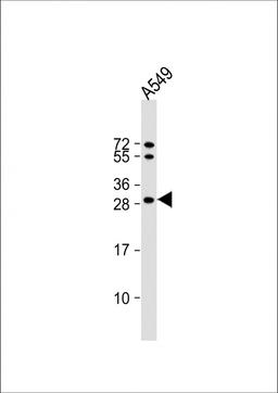 Western Blot at 1:1000 dilution + A549 whole cell lysate Lysates/proteins at 20 ug per lane.