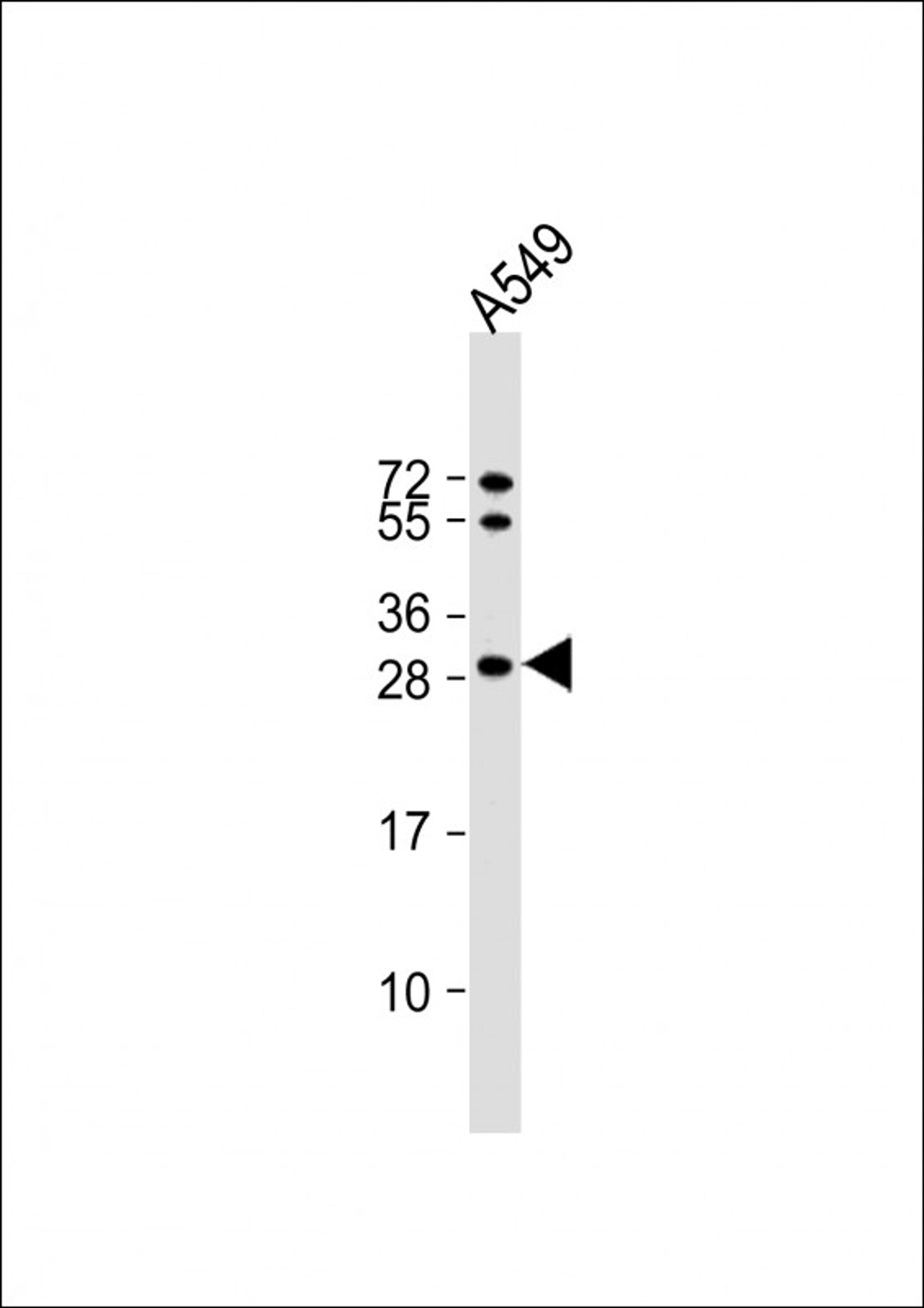 Western Blot at 1:1000 dilution + A549 whole cell lysate Lysates/proteins at 20 ug per lane.