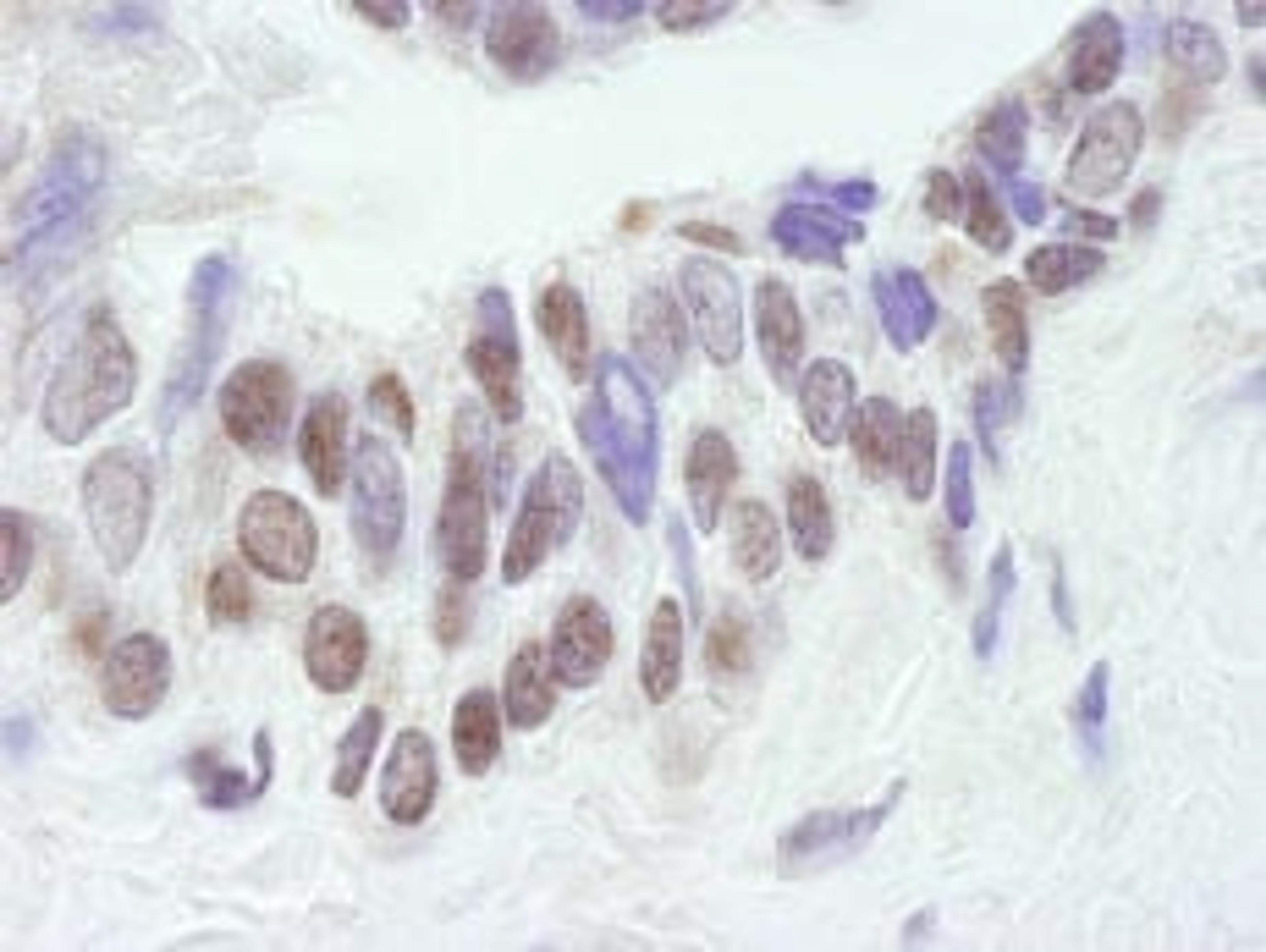 Detection of human CBP by immunohistochemistry.