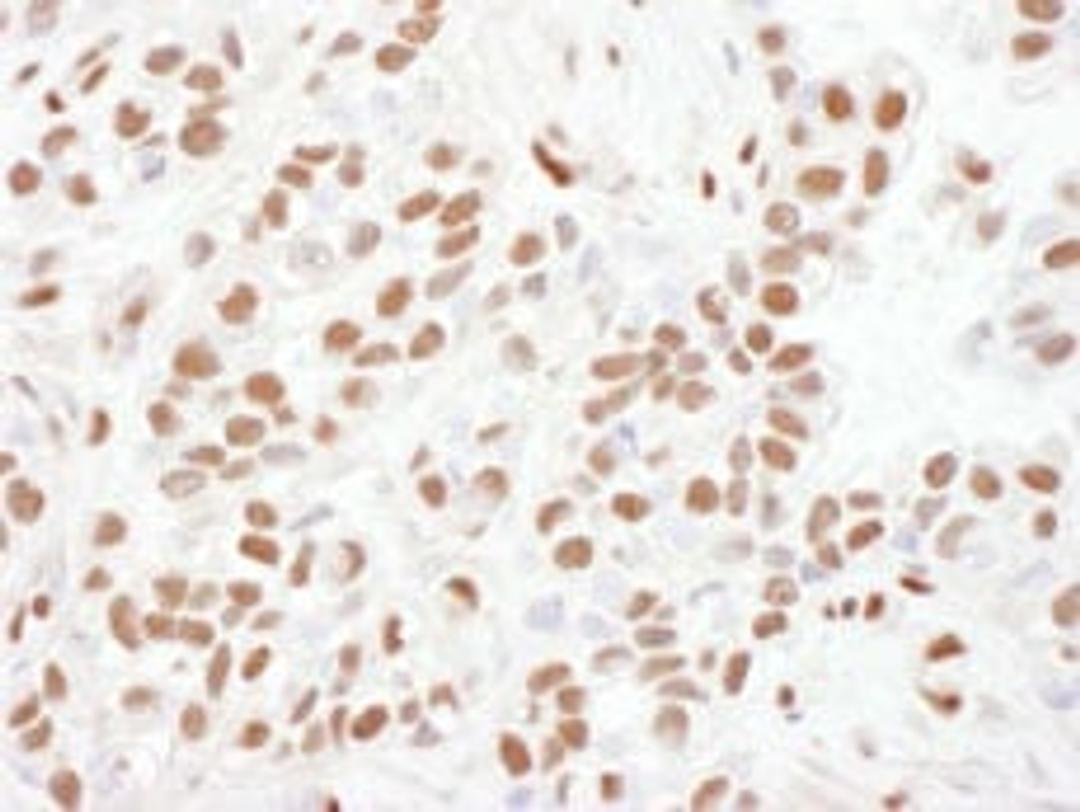 Detection of human 53BP1 by immunohistochemistry.