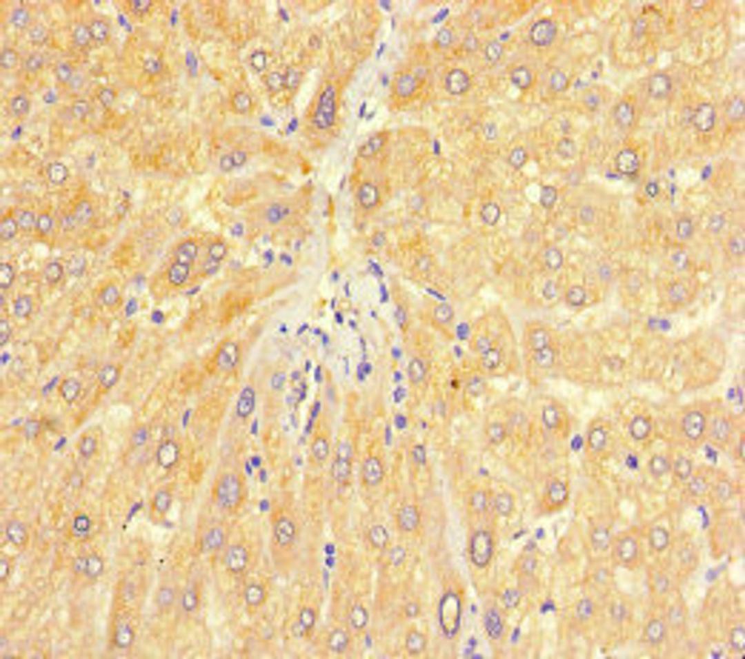 Immunohistochemistry of paraffin-embedded human liver tissue using CSB-PA01097A0Rb at dilution of 1:100