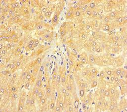 Immunohistochemistry of paraffin-embedded human liver tissue using CSB-PA01097A0Rb at dilution of 1:100