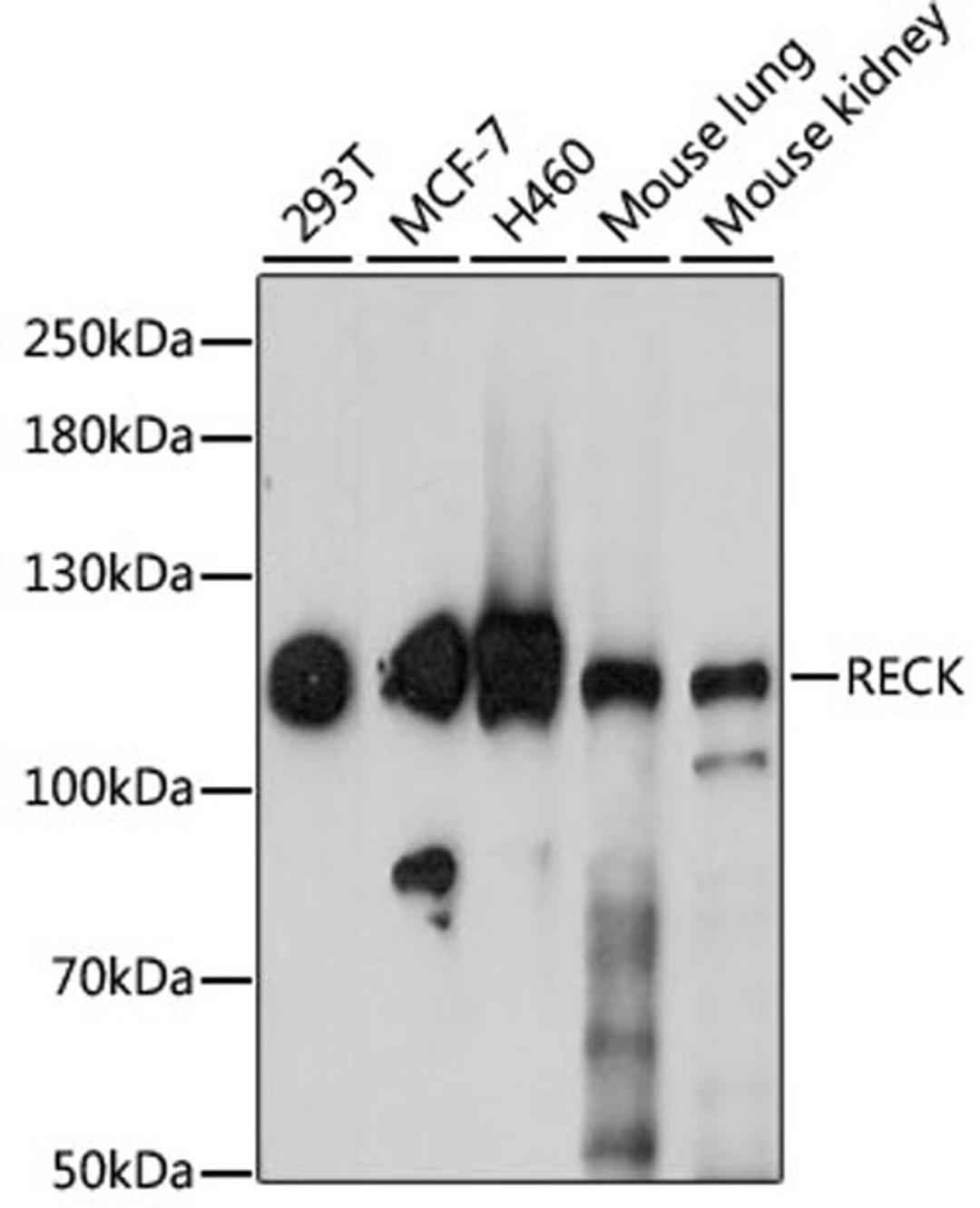 Western blot - RECK antibody (A6718)