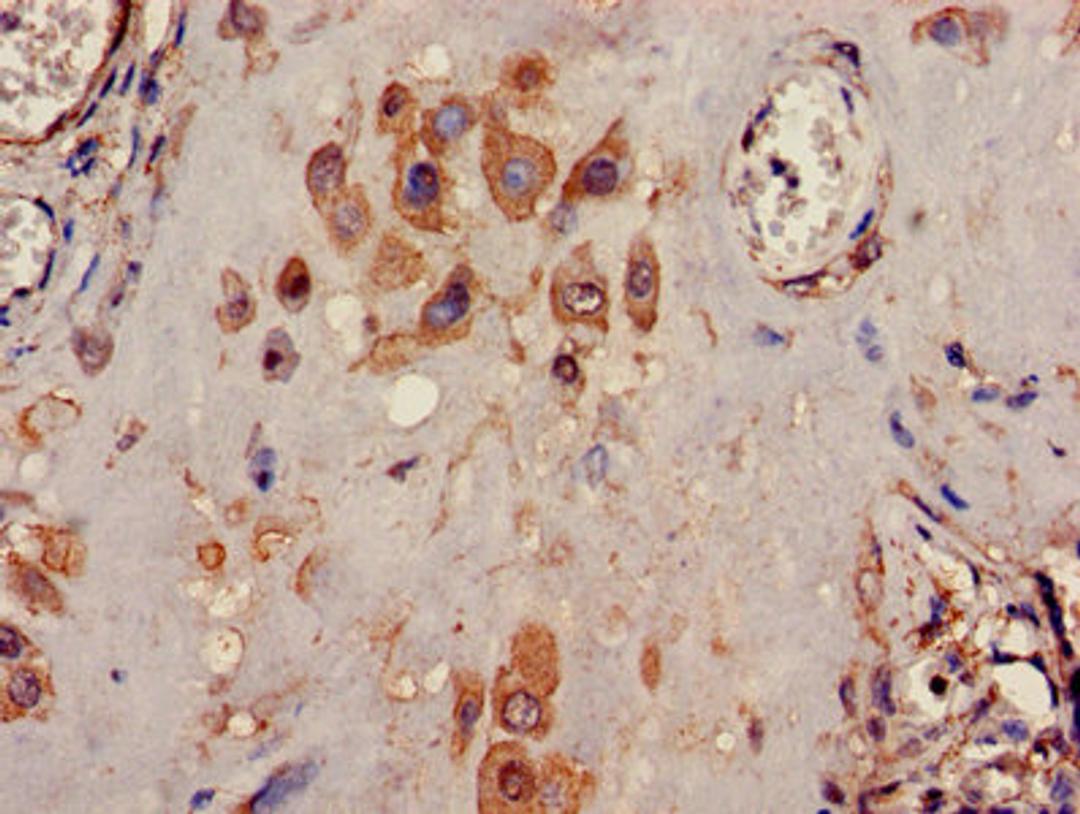 Immunohistochemistry of paraffin-embedded human placenta tissue using CSB-PA012062LA01HU at dilution of 1:100