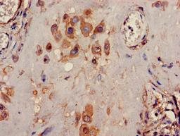 Immunohistochemistry of paraffin-embedded human placenta tissue using CSB-PA012062LA01HU at dilution of 1:100