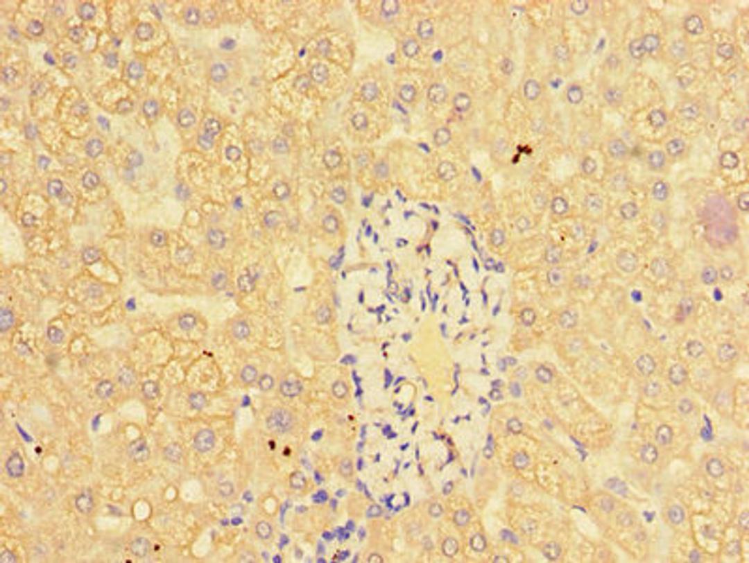 Immunohistochemistry of paraffin-embedded human liver tissue using CSB-PA11499A0Rb at dilution of 1:100