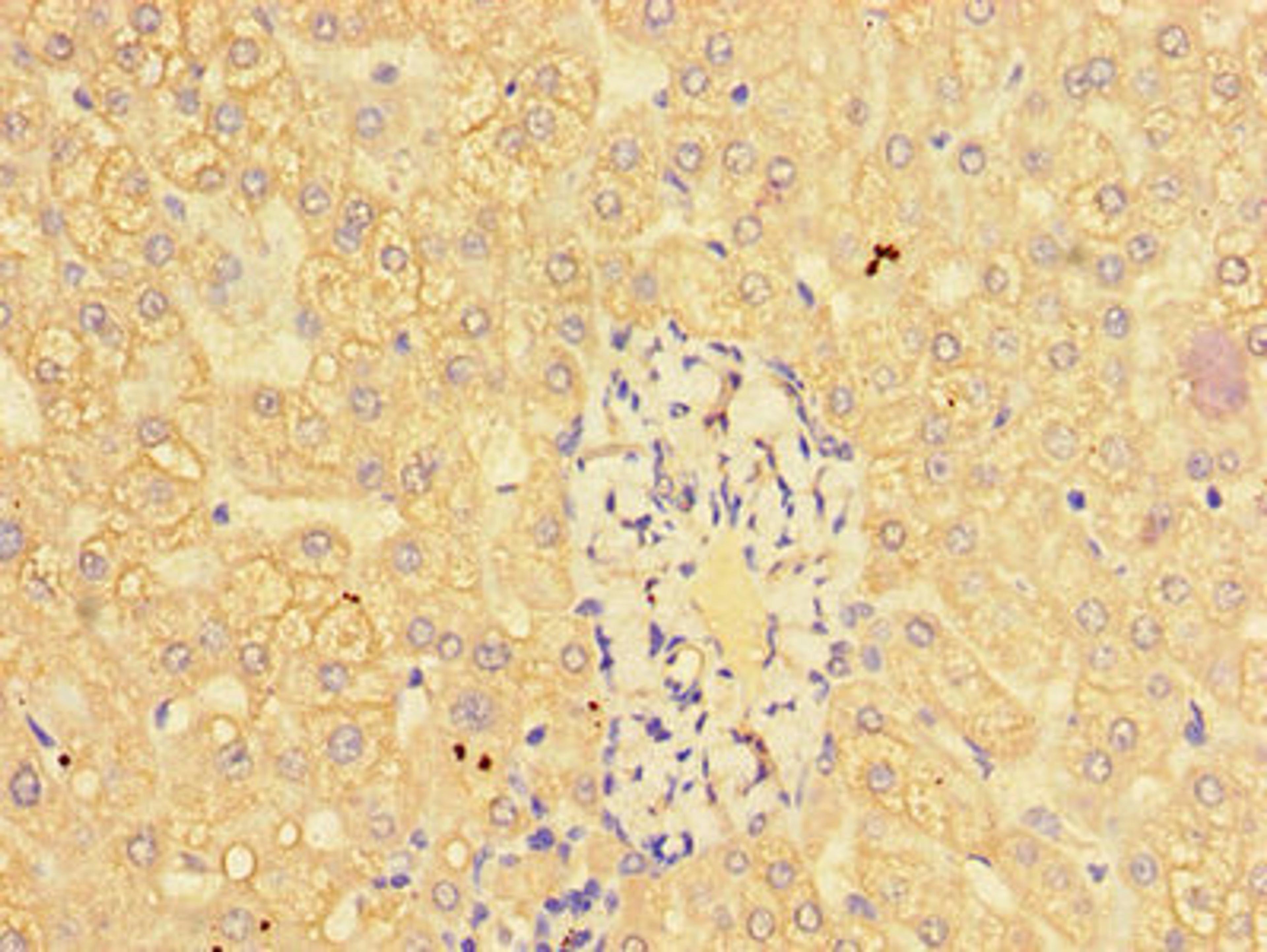Immunohistochemistry of paraffin-embedded human liver tissue using CSB-PA11499A0Rb at dilution of 1:100
