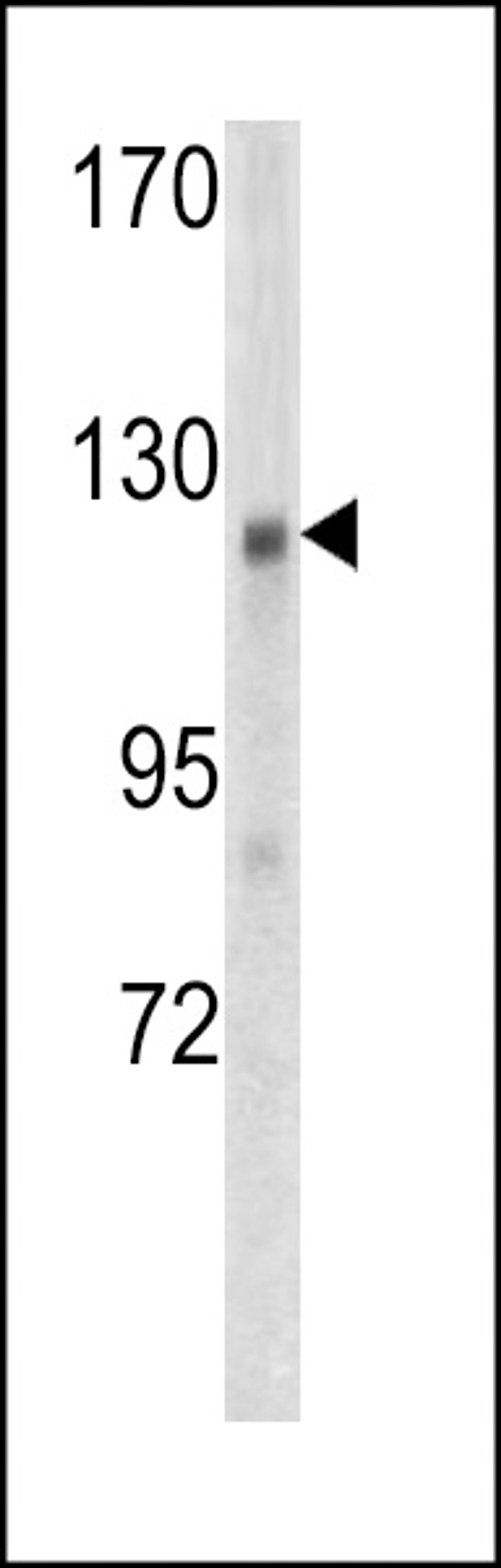 Western blot analysis of WTX antibody in mouse kidney tissue lysates (35ug/lane)