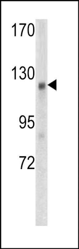 Western blot analysis of WTX antibody in mouse kidney tissue lysates (35ug/lane)