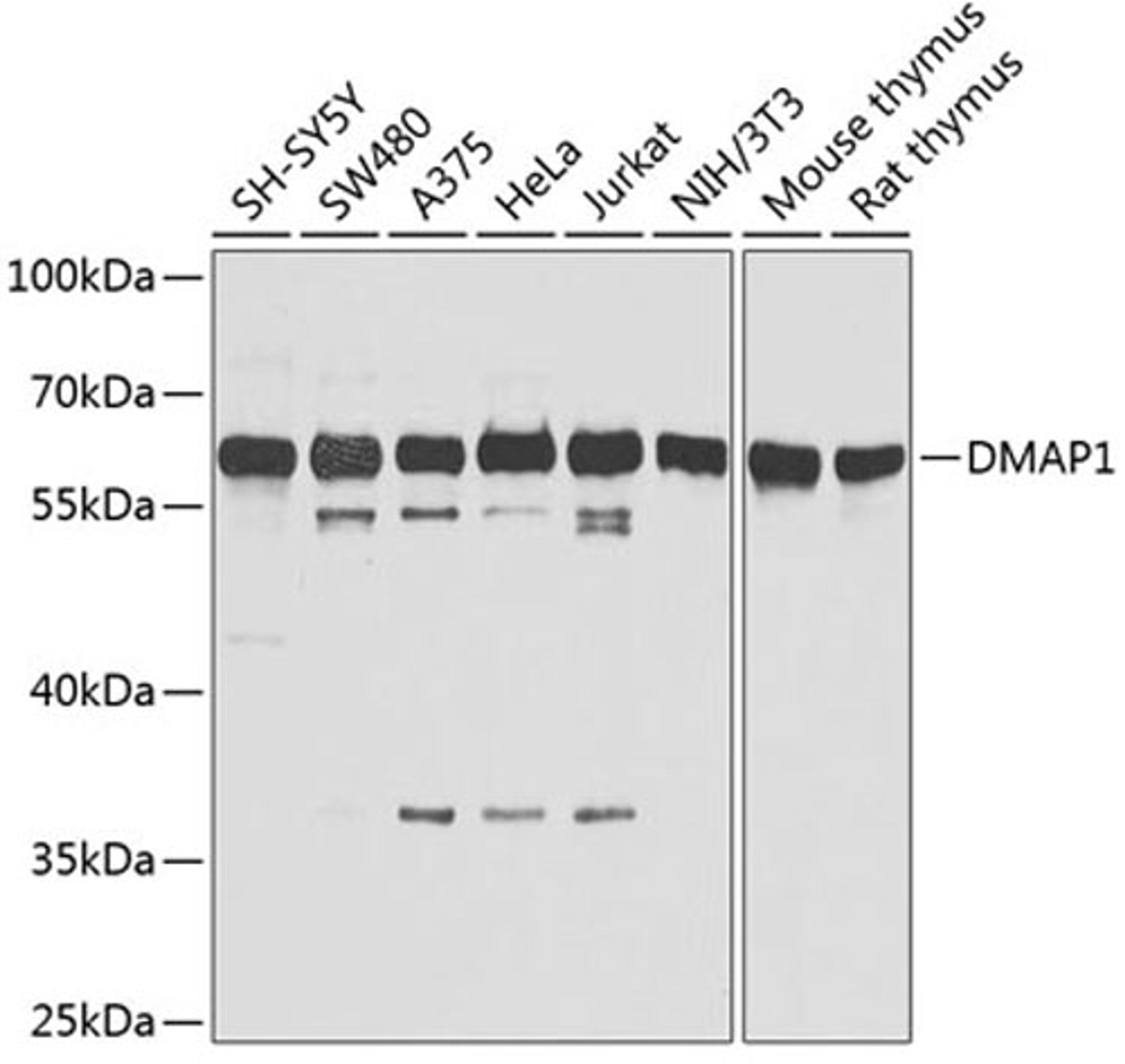 Western blot - DMAP1 antibody (A2324)