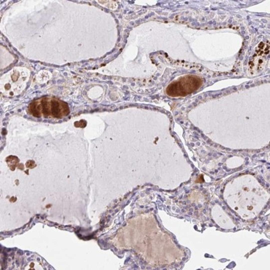 Immunohistochemistry: Zinc finger protein 581 Antibody [NBP2-31790] - Staining of human thyroid gland shows strong granular cytoplasmic positivity in glandular cells.