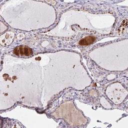 Immunohistochemistry: Zinc finger protein 581 Antibody [NBP2-31790] - Staining of human thyroid gland shows strong granular cytoplasmic positivity in glandular cells.