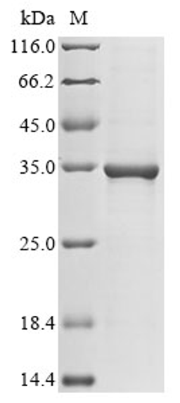 (Tris-Glycine gel) Discontinuous SDS-PAGE (reduced) with 5% enrichment gel and 15% separation gel.