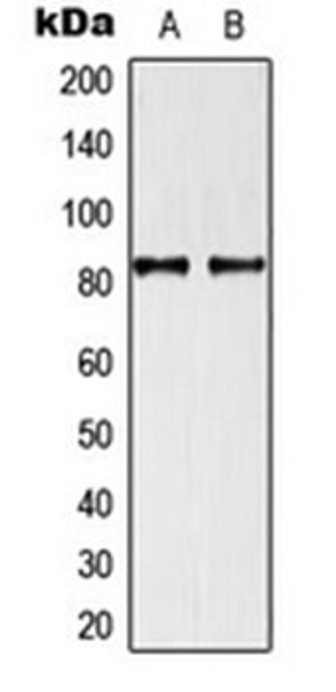 Western blot analysis of U87 (Lane 1), HeLa (Lane 2) whole cell lysates using TRAF3IP1 antibody