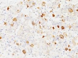 Formalin-fixed, paraffin-embedded human pituitary stained with FSH-beta antibody (SPM107).