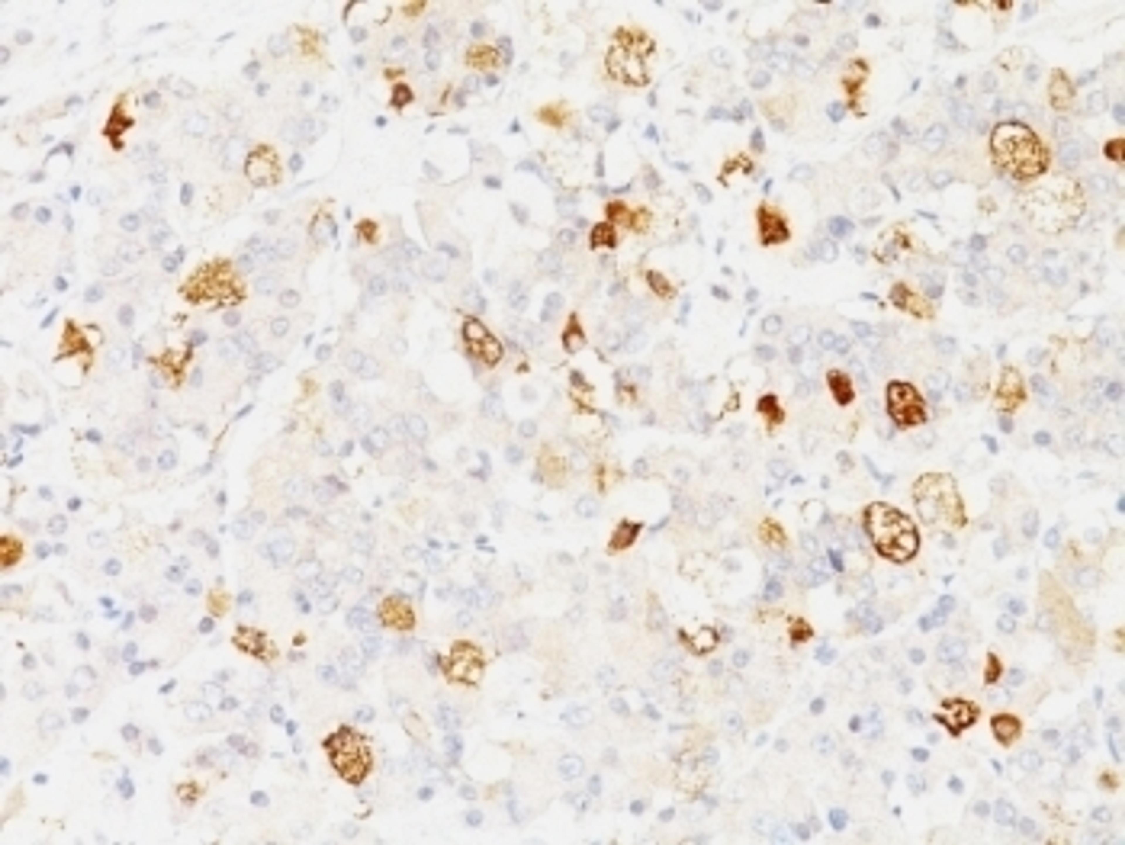 Formalin-fixed, paraffin-embedded human pituitary stained with FSH-beta antibody (SPM107).