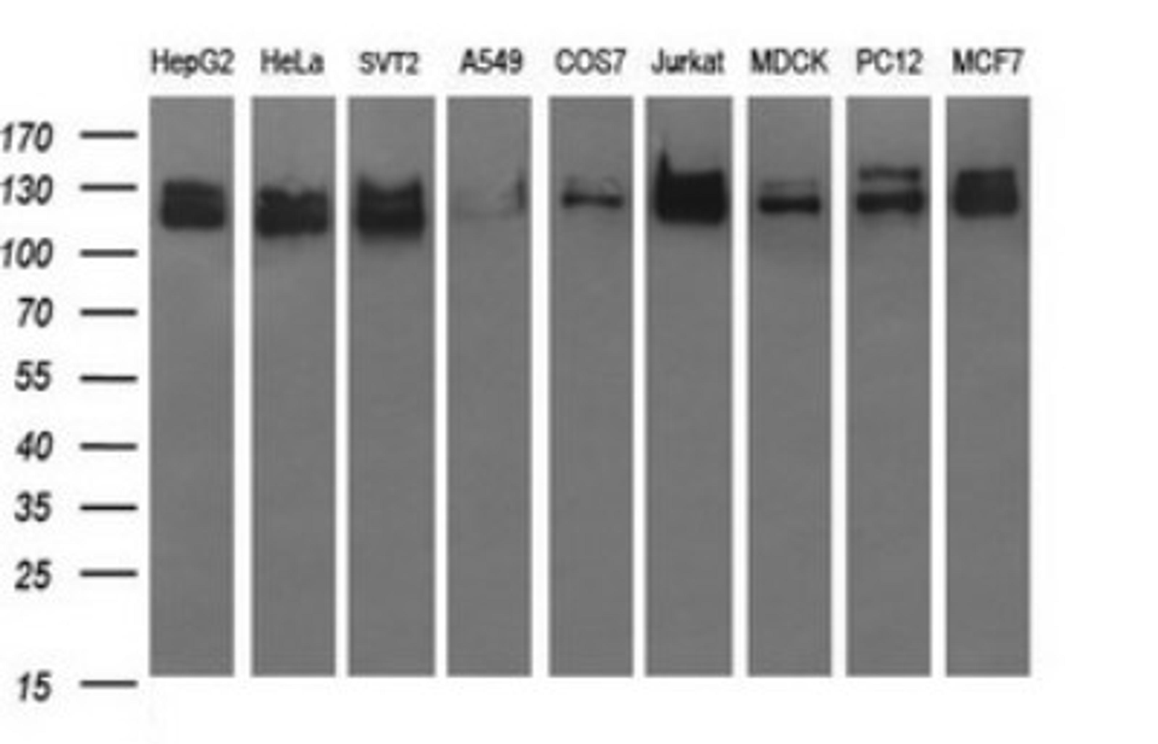 Western Blot: GRF2 Antibody (2F5) [NBP2-45515] - Analysis of extracts (35ug) from 9 different cell lines (HepG2: human; HeLa: human; SVT2: mouse; A549: human; COS7: monkey; Jurkat: human; MDCK: canine; PC12: rat; MCF7: human).