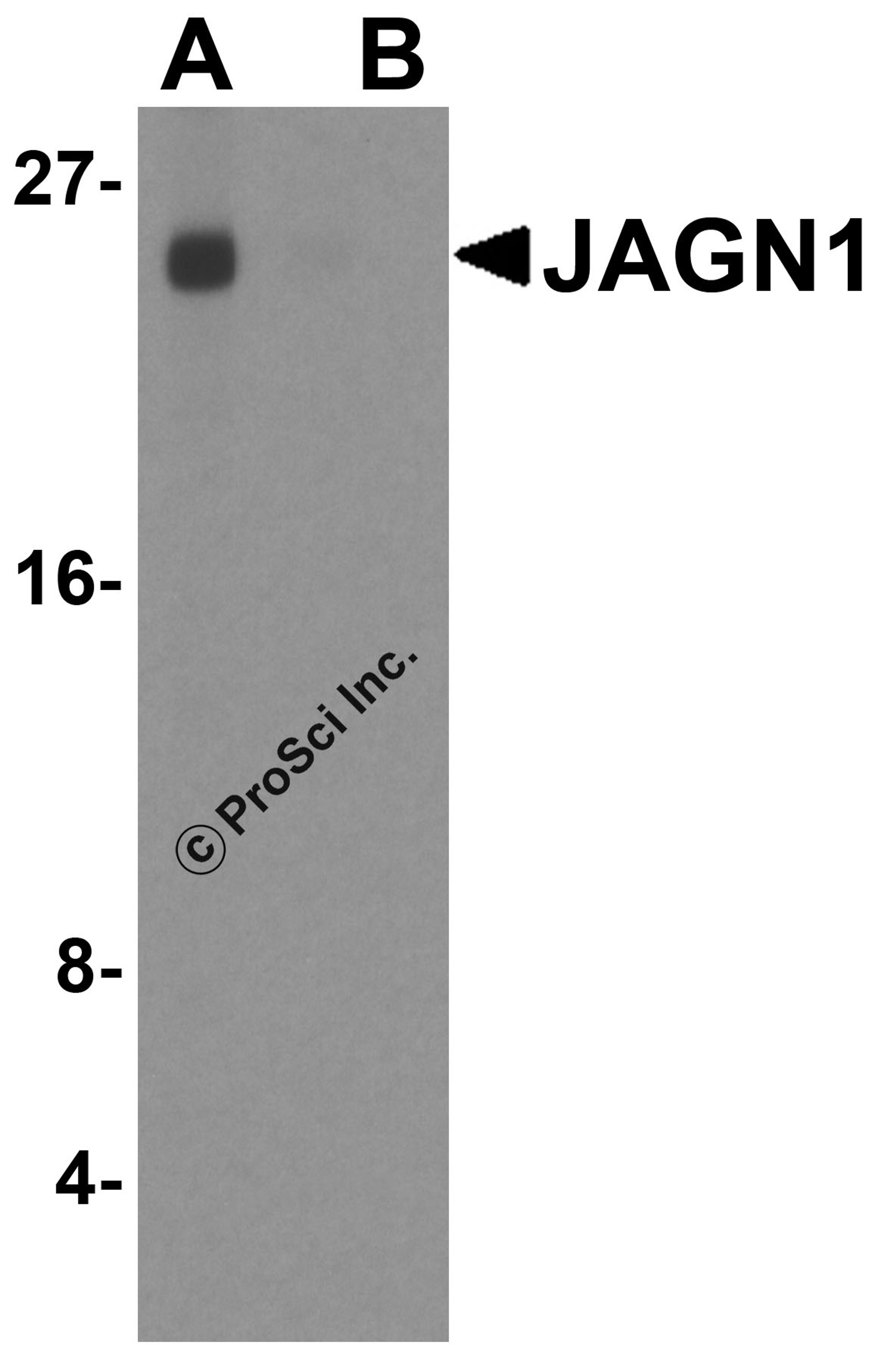 Western blot analysis of JAGN1 in MCF7 cell lysate with JAGN1 antibody at 1 μg/ml in (A) the absence and (B) the presence of blocking peptide.