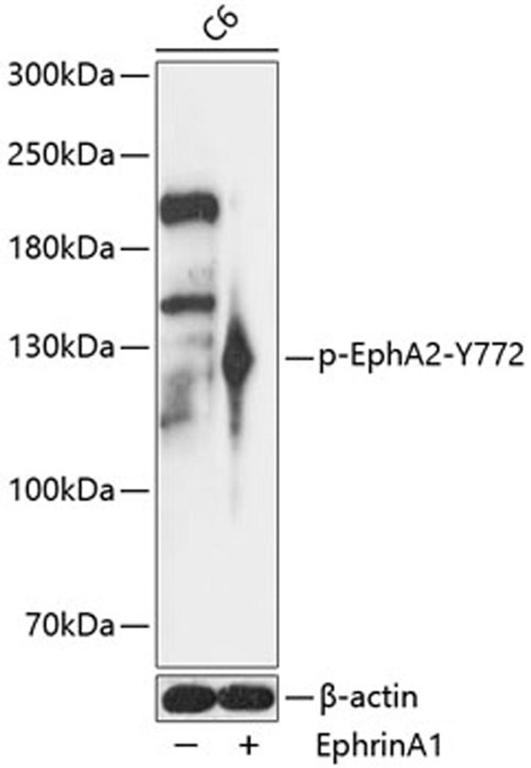 Western blot - Phospho-EphA2-Y772 antibody (AP0817)