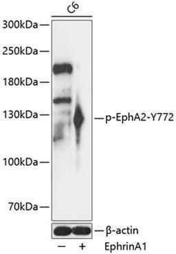 Western blot - Phospho-EphA2-Y772 antibody (AP0817)