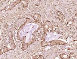 Immunohistochemical staining of rat uterus tissue using TRRAP antibody