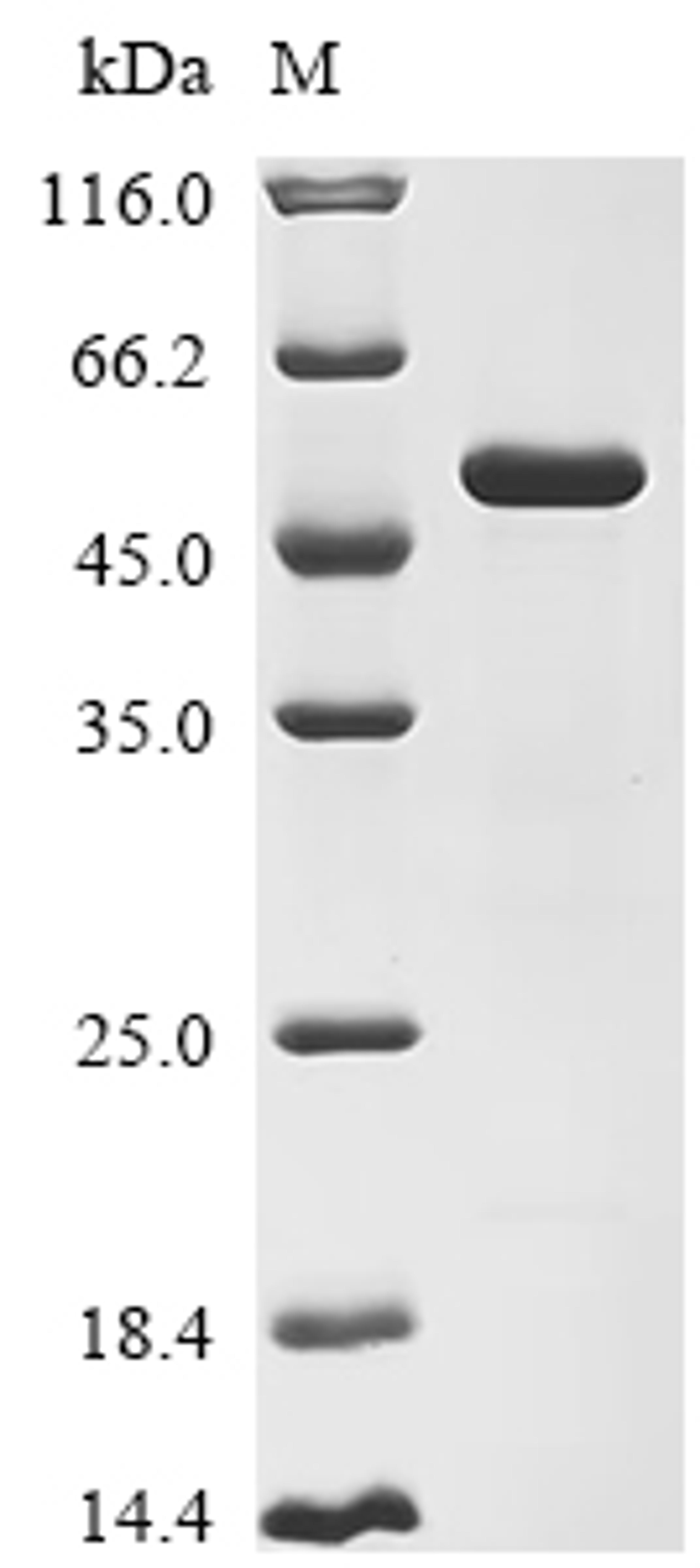 (Tris-Glycine gel) Discontinuous SDS-PAGE (reduced) with 5% enrichment gel and 15% separation gel.