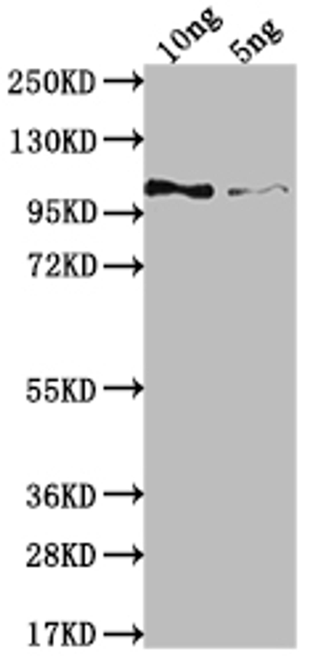 Western Blot. Positive WB detected in Recombinant protein. All lanes: Genome polyprotein Antibody antibody at 1:2000. Secondary. Goat polyclonal to rabbit IgG at 1/50000 dilution. Predicted band size: 87.3 kDa. Observed band size: 105 kDa. 