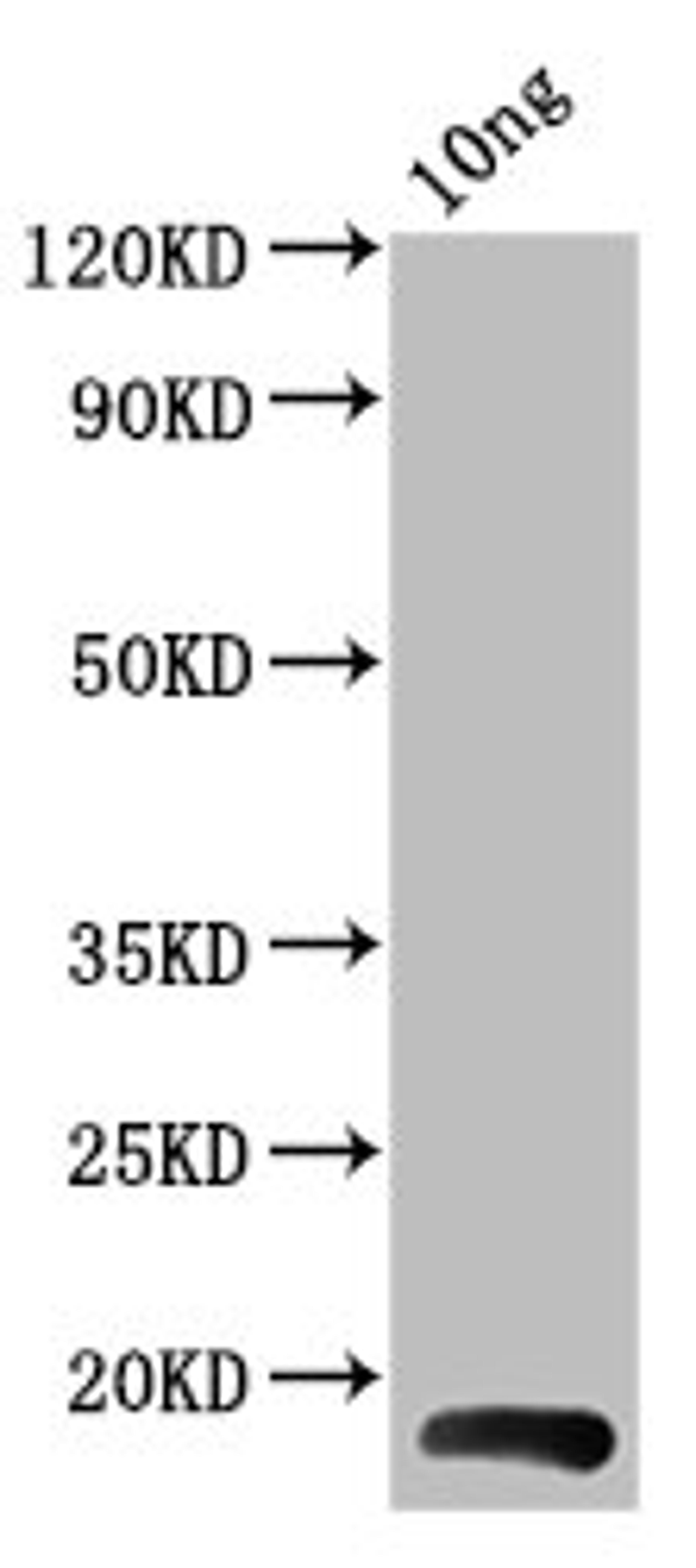 Western Blot. Positive WB detected in Recombinant protein. All lanes: BHRF1 antibody at 4ug/ml. Secondary. Goat polyclonal to rabbit IgG at 1/50000 dilution. Predicted band size: 18 kDa. Observed band size: 18 kDa. 