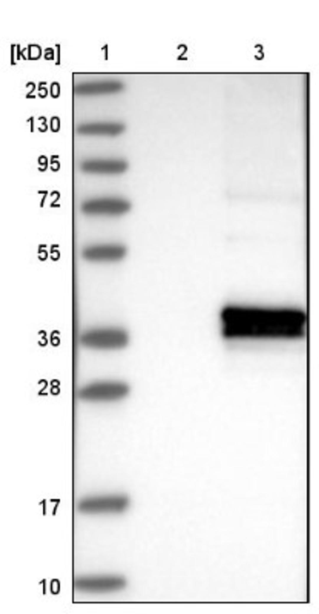 Western Blot: ABHD13 Antibody [NBP1-88978] - Lane 1: Marker [kDa] 250, 130, 95, 72, 55, 36, 28, 17, 10<br/>Lane 2: Negative control (vector only transfected HEK293T lysate)<br/>Lane 3: Over-expression lysate (Co-expressed with a C-terminal myc-DDK tag (~3.1 kDa) in mammalian HEK293T cells, LY409893)