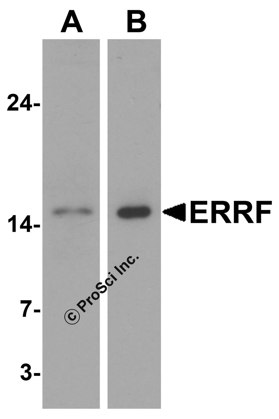 Western blot analysis of ERRF in (A) HeLa and (B) A-20 cell lysate with ERRF antibody at 1 μg/mL.
